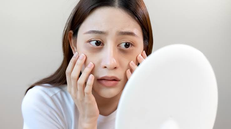 How Stress Affects Your Skin and Weight