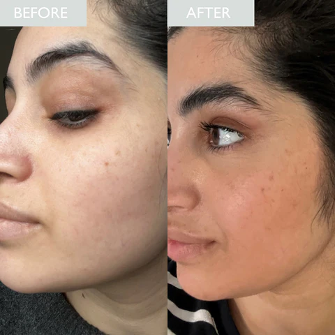 Why Your Skin Looks Dull